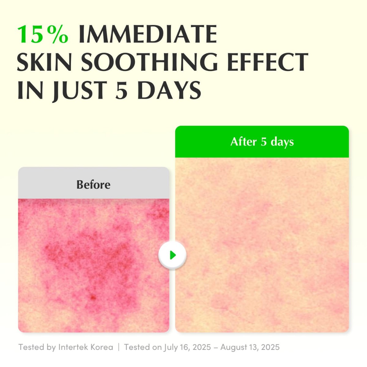 Eqqualberry - Aloe PDRN Calming Serum 30 ml - Image 6