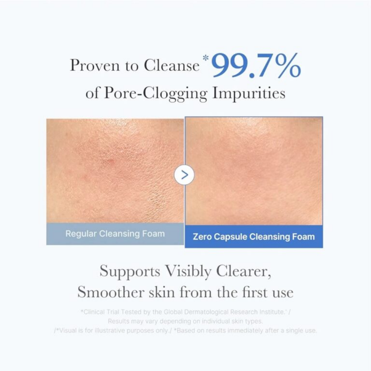 Medicube - Zero Pore SA Clearing Capsule Cleansing Foam 120 g Medicube - Zero Pore SA Clearing Capsule Cleansing Foam 120 g - Image 4