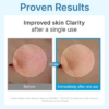 Centellian24 - Hyal Waterfull Glow Gel Mask – product image 4