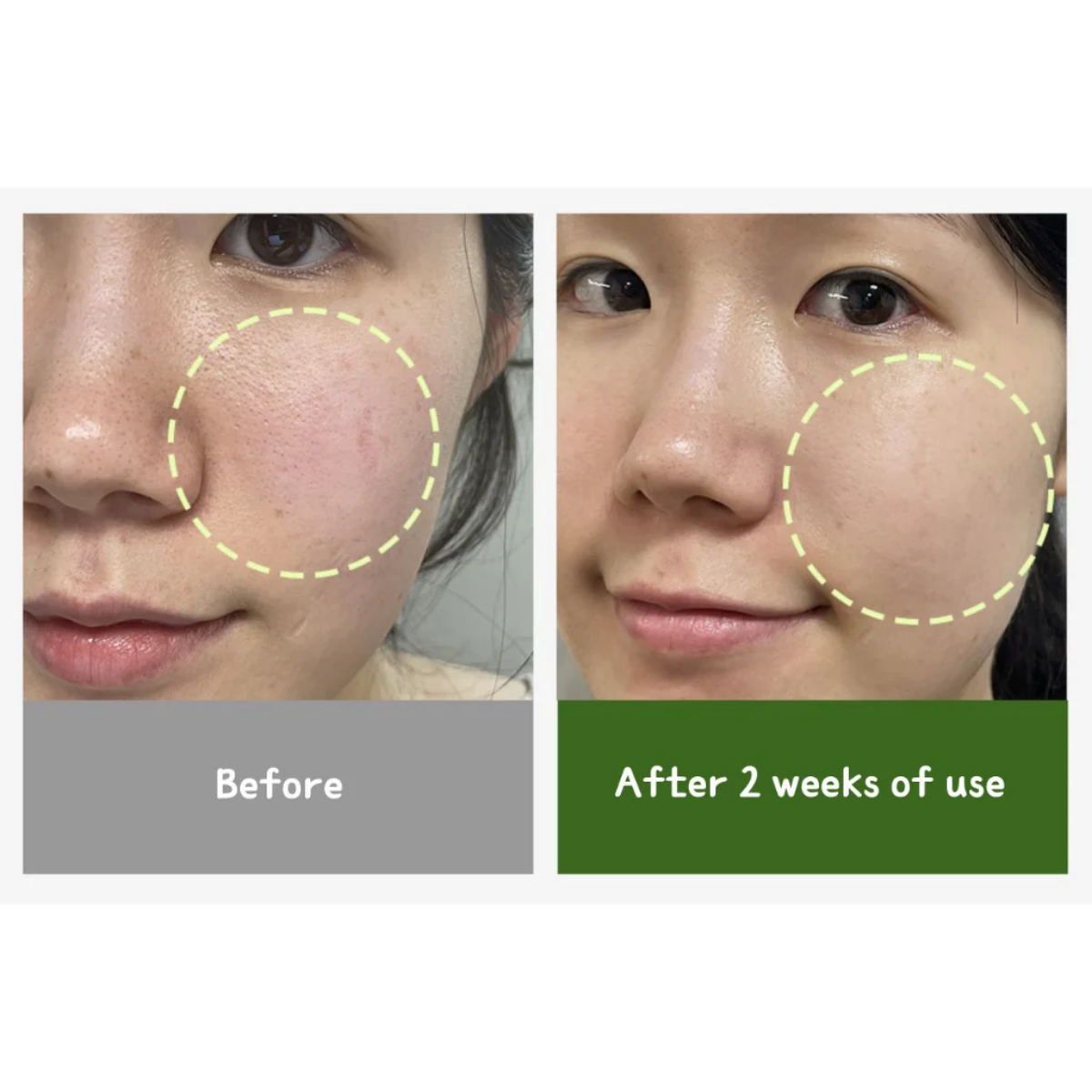 Sungboon Editor - Green Tomato Pore Zero Ampoule 40 ml Sungboon Editor - Green Tomato Pore Zero Ampoule 40 ml - Image 4