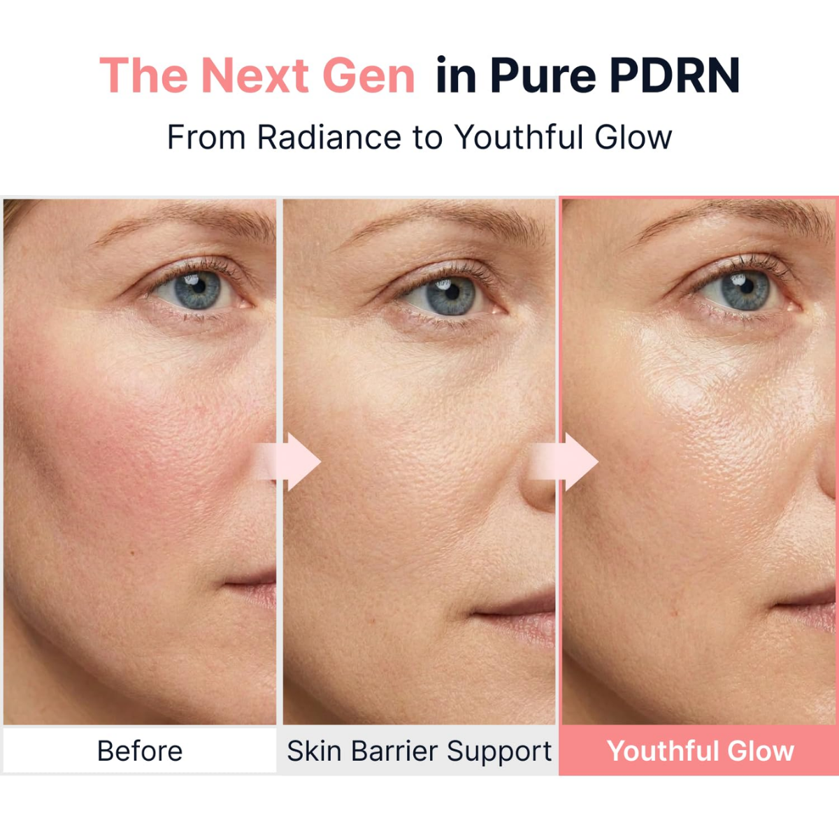 Sungboon Editor - PDRN Pink Vitamin Glow Boosting Ampoule 40 ml Sungboon Editor - PDRN Pink Vitamin Glow Boosting Ampoule 40 ml - Image 6